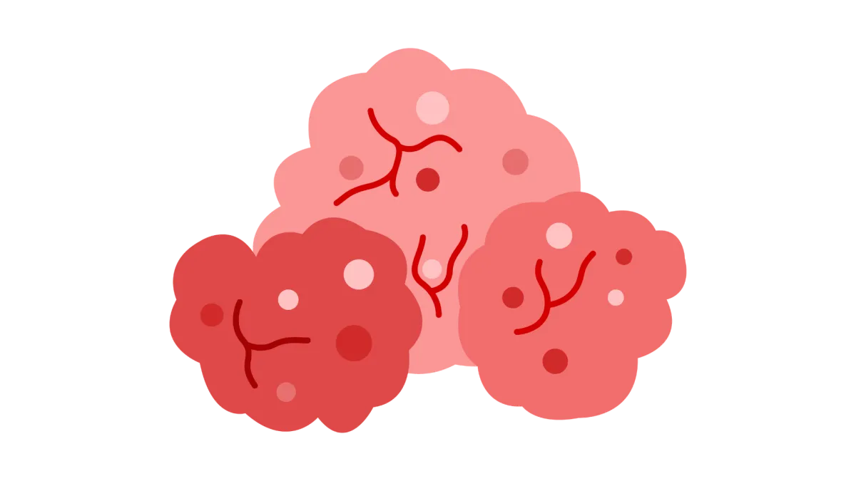 Large Language Models Development Company